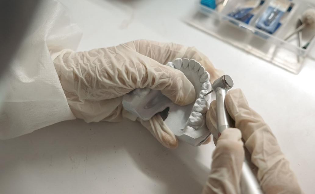 Laboratorio protésico propio de Clínica Dental Estudio 32