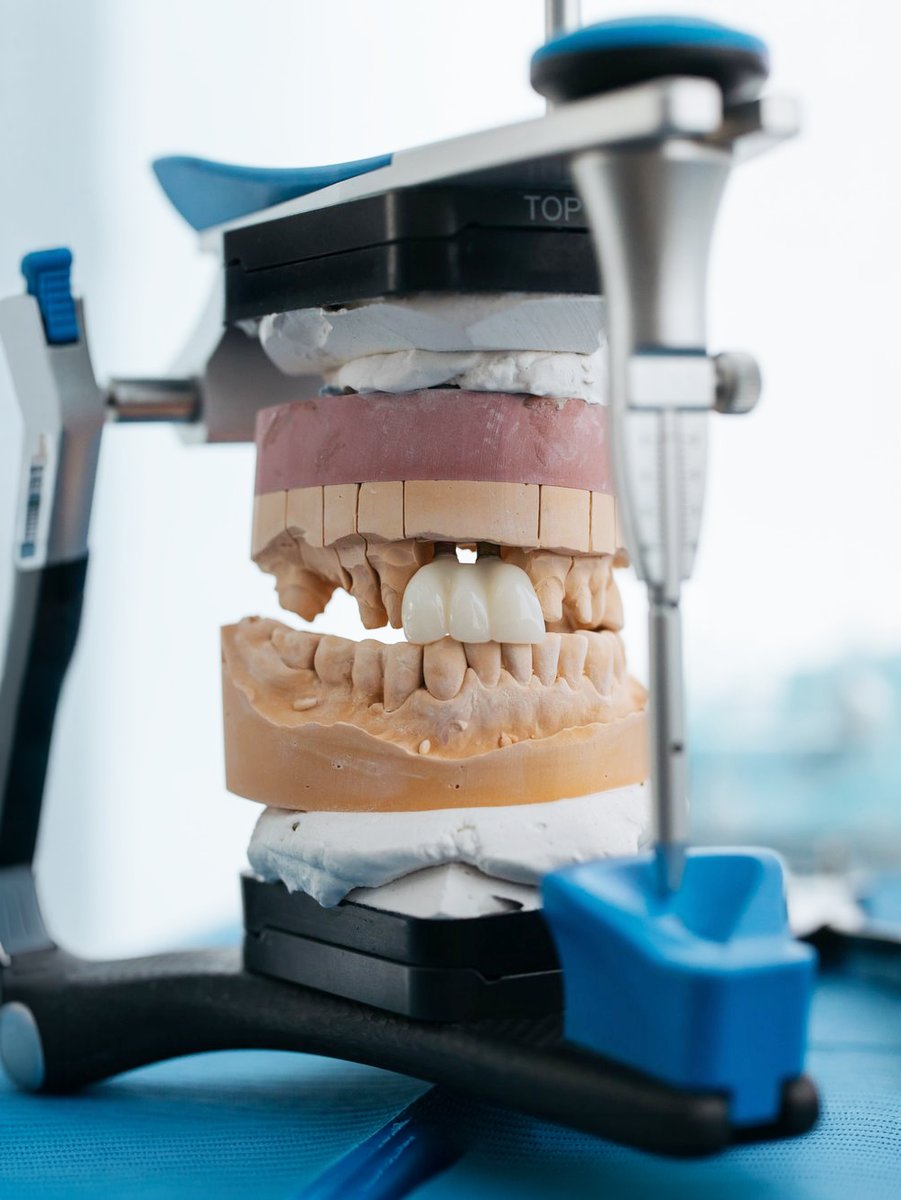 Tratamiento de implantes dentales en Clínica Dental Estudio 32, Telde