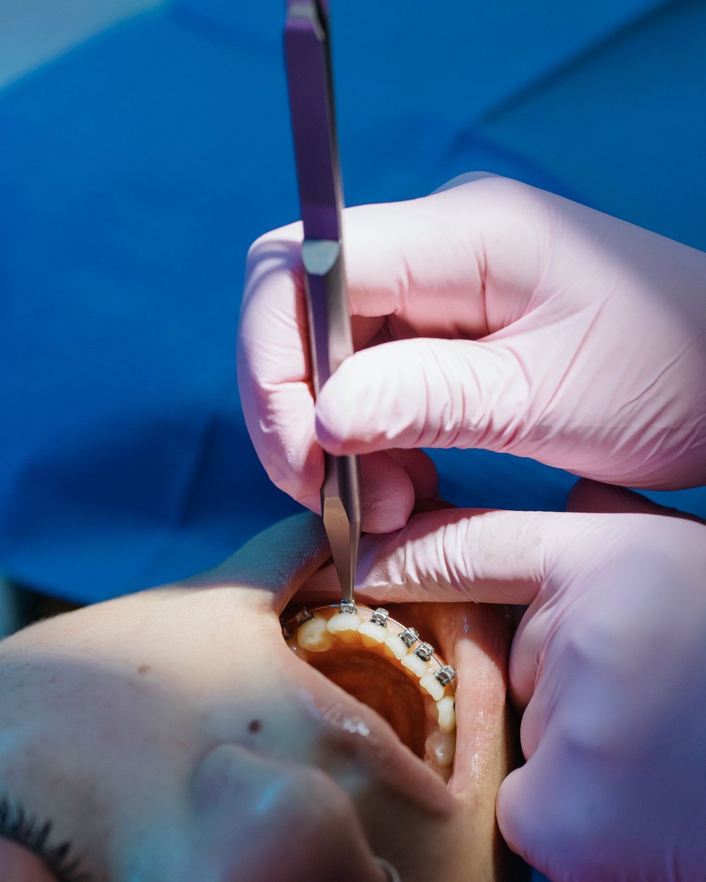 Tratamiento de ortodoncia en Clínica Dental Estudio 32, Telde